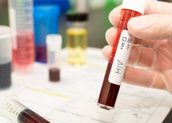 Mujer se curó de VIH tras transplante de sangre de células madre de cordón umbilical